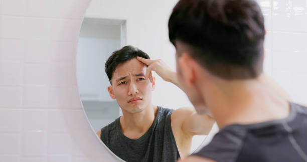 man worry about hair loss - hairstyle stock pictures, royalty-free photos & images