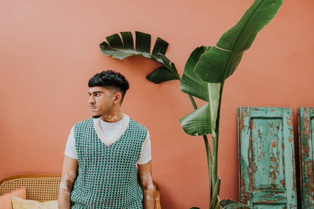 portrait of a confident, stylish young man with vitiligo - side profile - fashion stock pictures, royalty-free photos & images