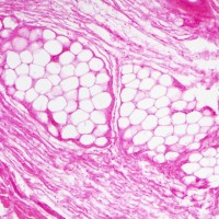 fat tissue,10x light micrograph - junk food stock pictures, royalty-free photos & images