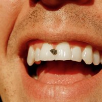 man with food in his teeth - food photos et images de collection