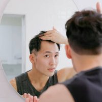 mann sorgt sich um haarausfall - hairstyle stock-fotos und bilder