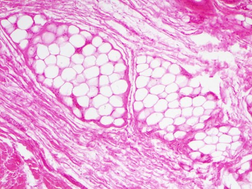 fat tissue,10x light micrograph - junk food stock pictures, royalty-free photos & images