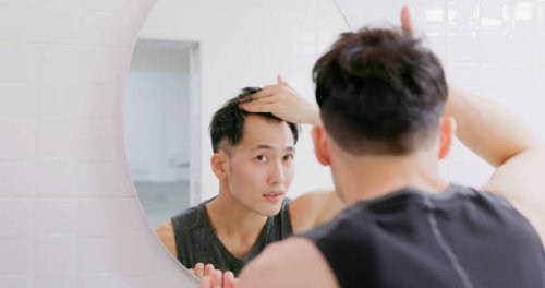 mann sorgt sich um haarausfall - hairstyle stock-fotos und bilder