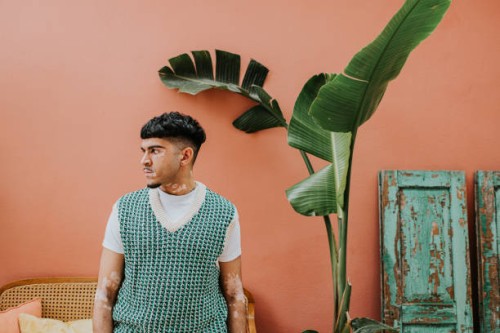 portrait of a confident, stylish young man with vitiligo - side profile - fashion stock pictures, royalty-free photos & images
